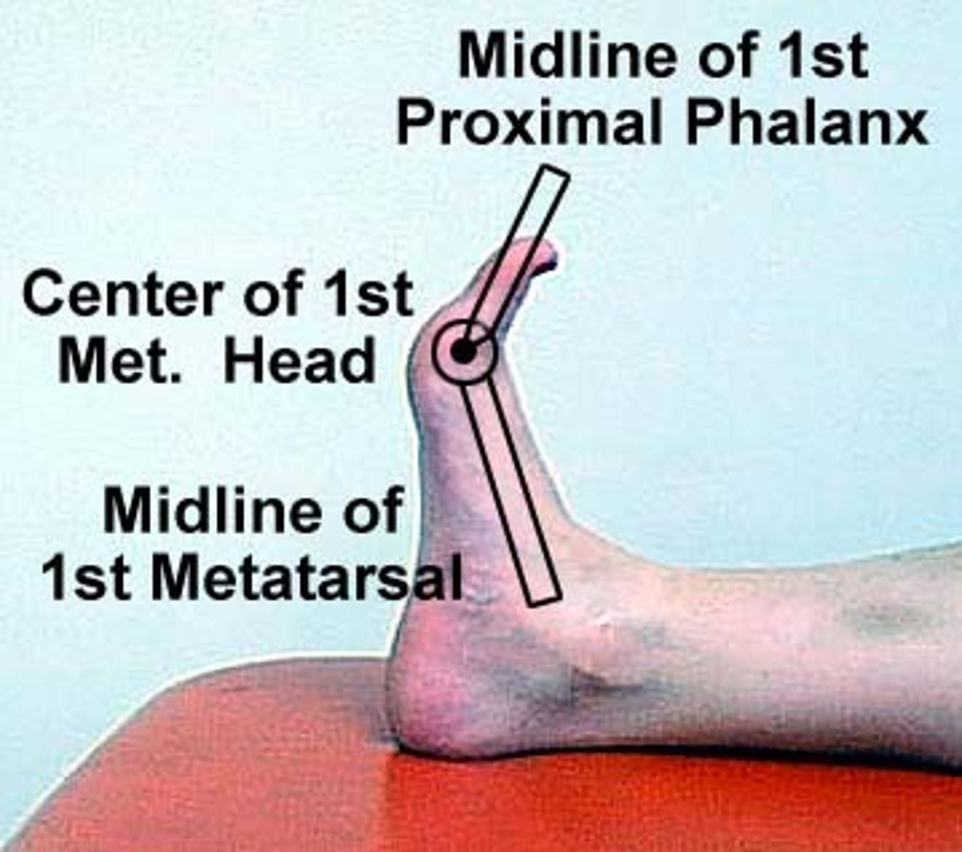 <p>supine, feet off table </p><p>stationary arm: 1st metatarsal </p><p>fulcrum: 1st MTP joint </p><p>moving arm: 1st phalange </p>
