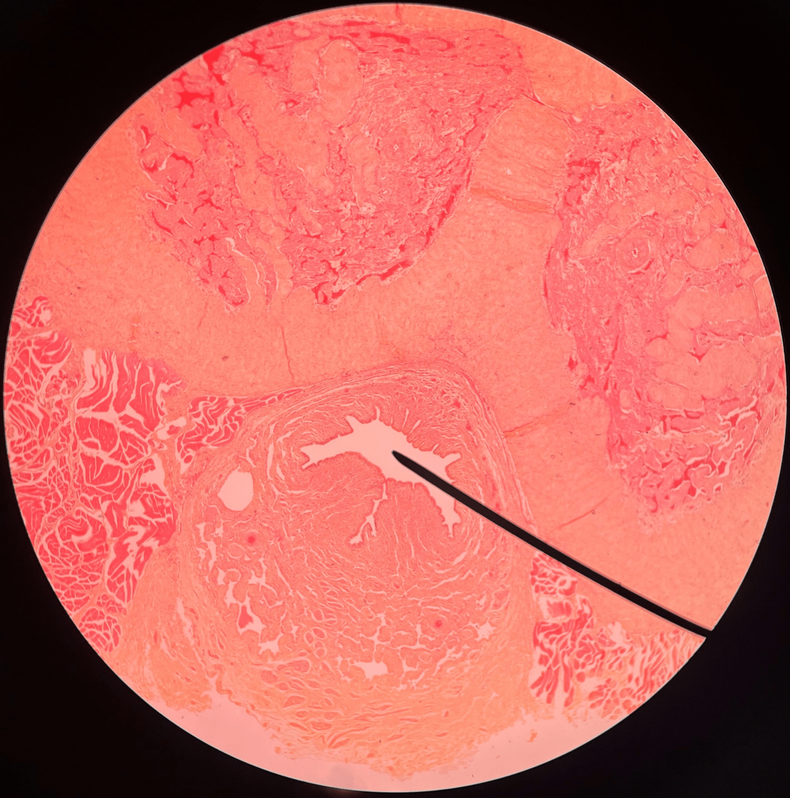 • Slide histology of a c.s. of the penis.

• The final segment of the urethra.