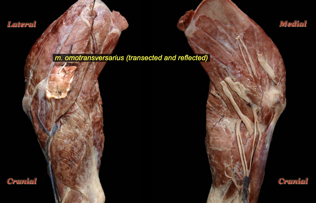 <p>O: Distal scapular spine<br>I: Wing of atlas</p><p>N: Branches from accessory n.<br>A: Draw limb craniad</p>