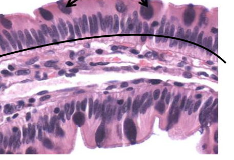 <p>Simple:</p><ul><li><p> One layer of cells is present</p></li></ul><p>Columnar:</p><p>• Apical cells are column shaped in cross section</p><p>• Cells are taller than they are wide</p><p>• Oval nuclei, located near the basal surface</p><p>• Cells may display apical cilia and/or goblet cells</p><p></p>