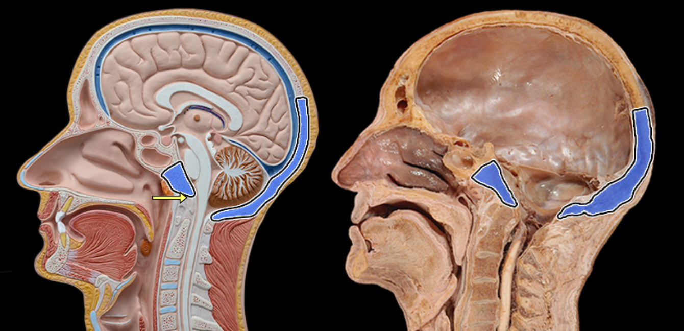 <p>Occipital bone</p>