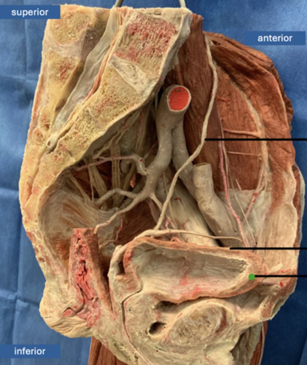 <p>muscle</p>
