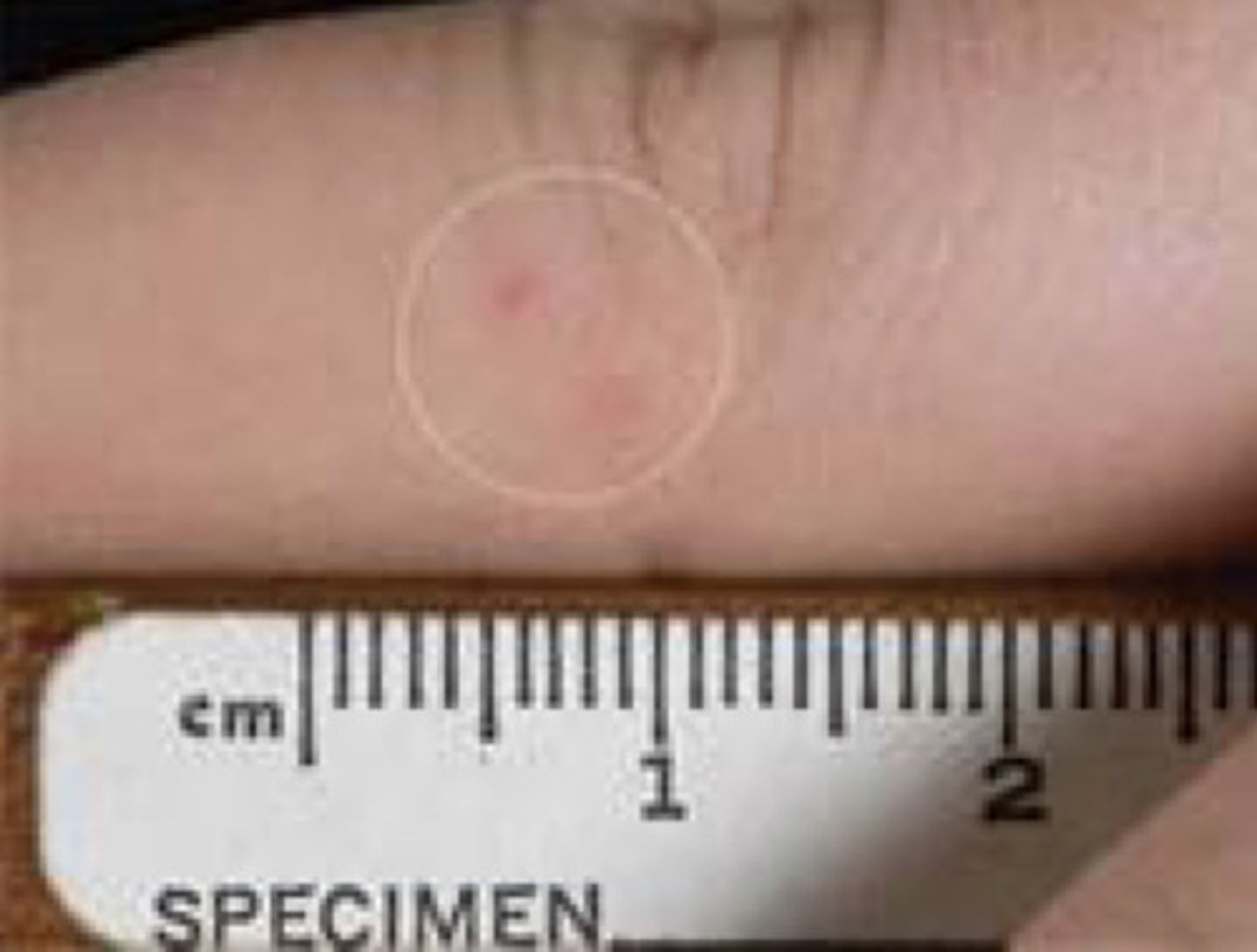 <p>Which animal type can transmit rabies through a very minor wound that may be difficult to see?</p>