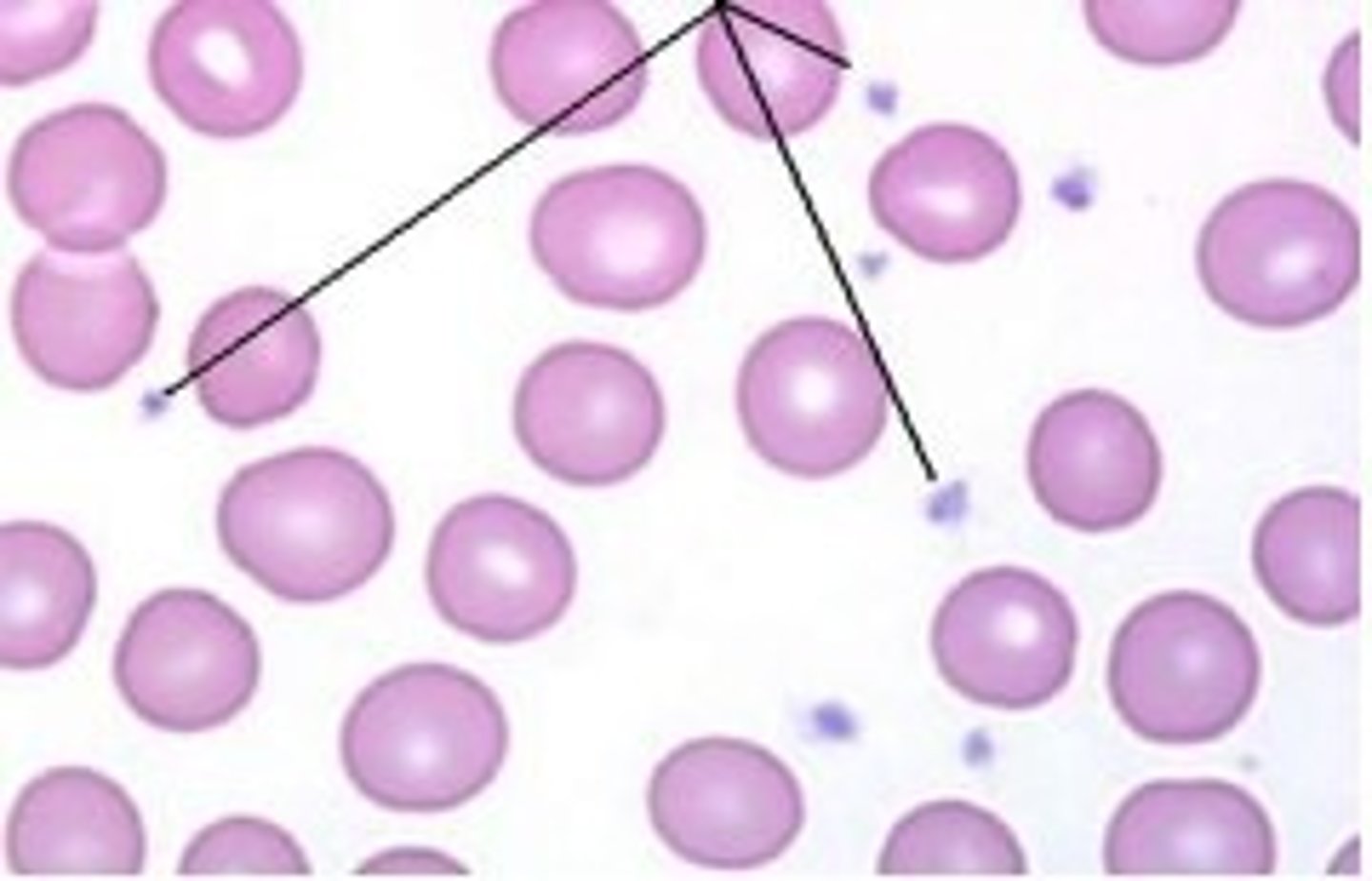 <p>cellular fragments involved in clotting that lack nuclei &amp; most organelles &amp; are very small</p>