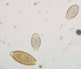 <p>adults are located in nasal cavities and sinuses </p>