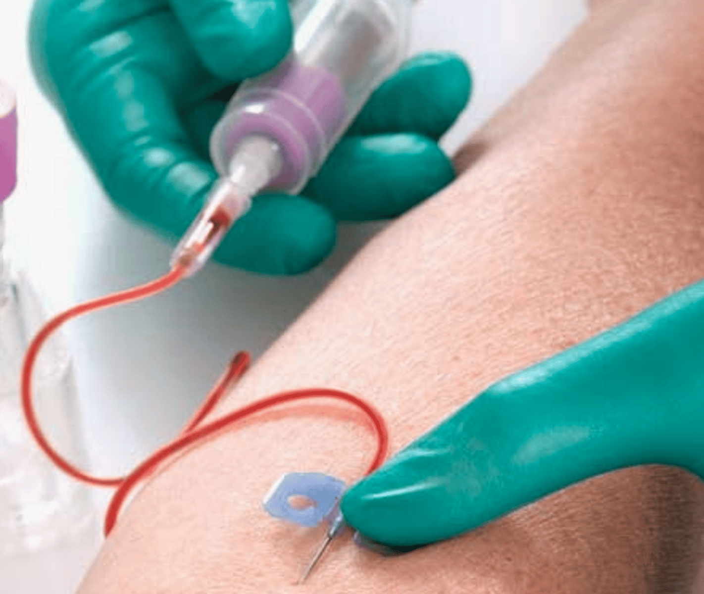 <p>Who receives: everybody 20+</p><p>Aimed to prevent: heart attack/stroke</p><p>Screening Frequency: 4-6 yrs</p>