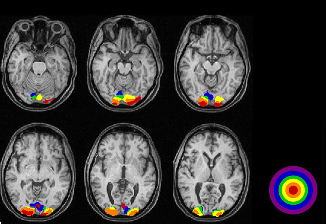 <ul><li><p>active neurons have increased blood flow</p></li><li><p>detect changes in regional blood flow and blood O<sub>2</sub>&nbsp;in the brain</p></li></ul><p></p>