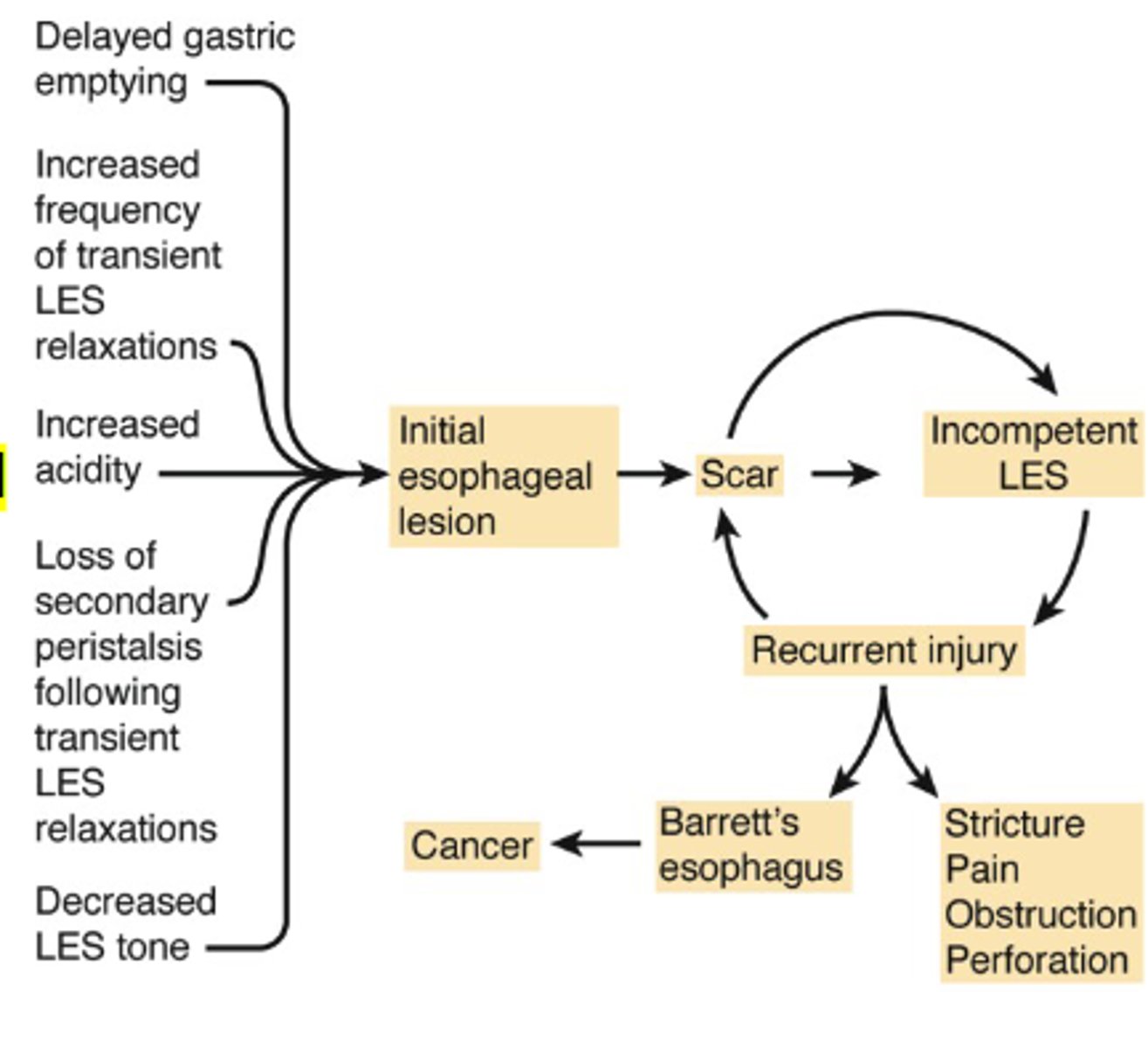 <p>effectiveness of barrier to reflux of acid from stomach is lost by loss of esophageal sphincter tone</p><p>causes recurrent reflux and inflammation</p>