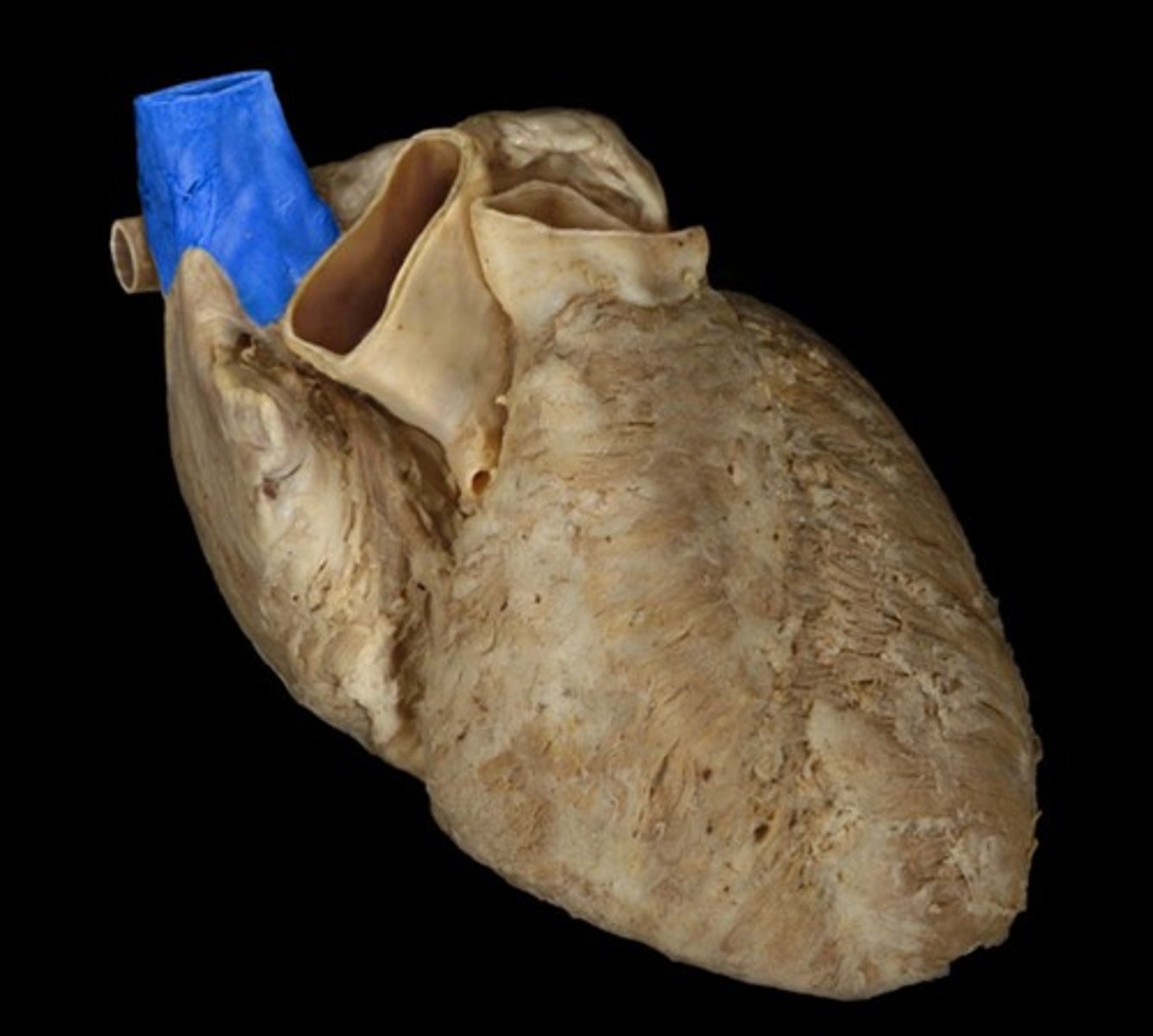 <p>vein</p>