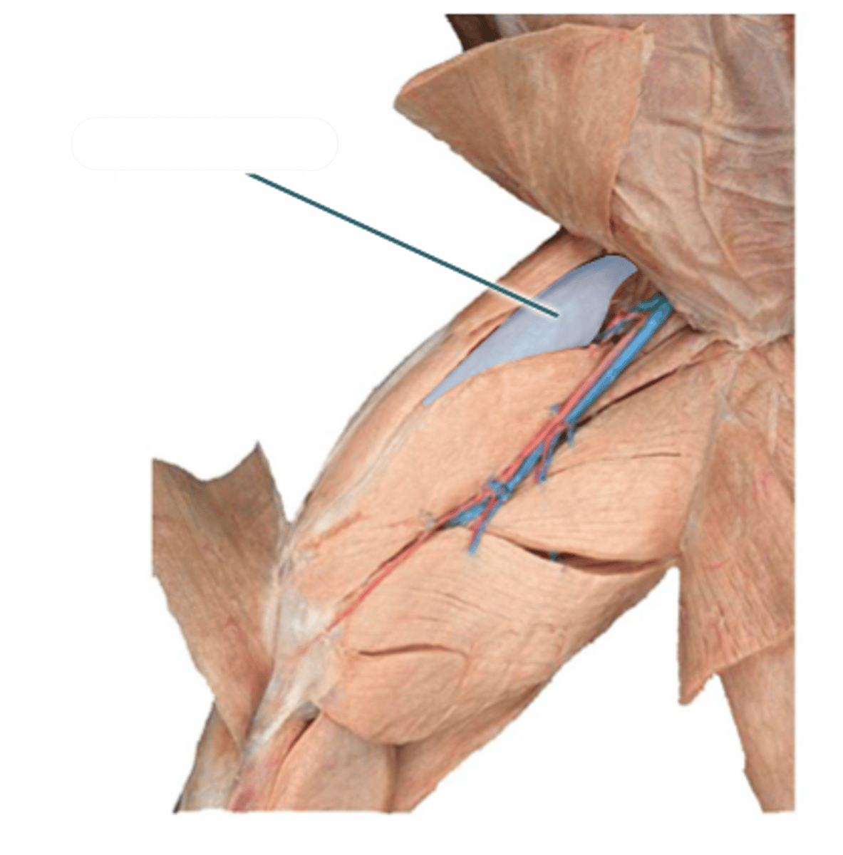 <p>what muscle is highlighted?</p>