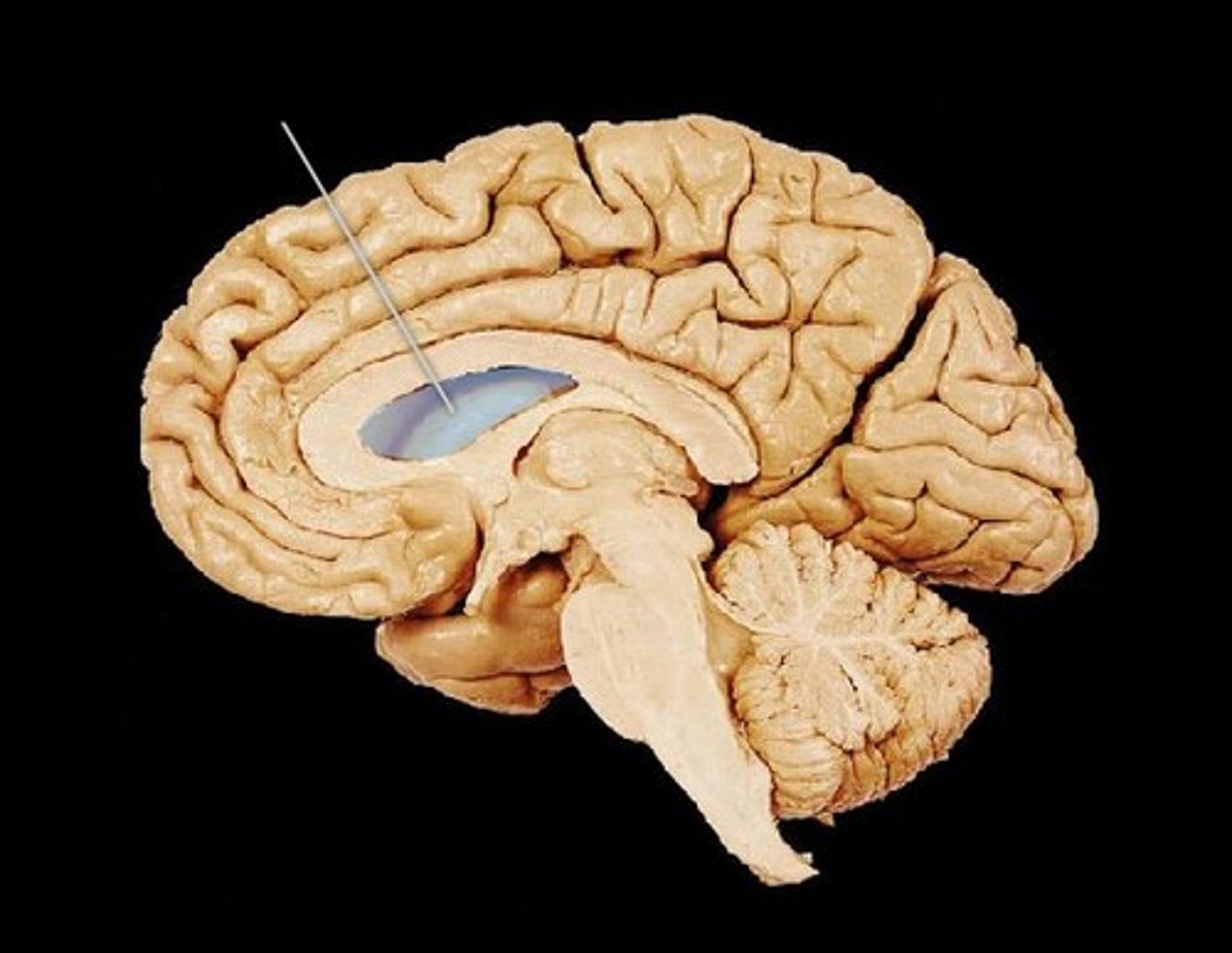 <p>Paired chambers within cerebrum; contain CSF.</p>