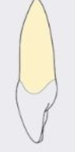 <p>pointed or slightly rounded, flattens with wear and slopes</p>