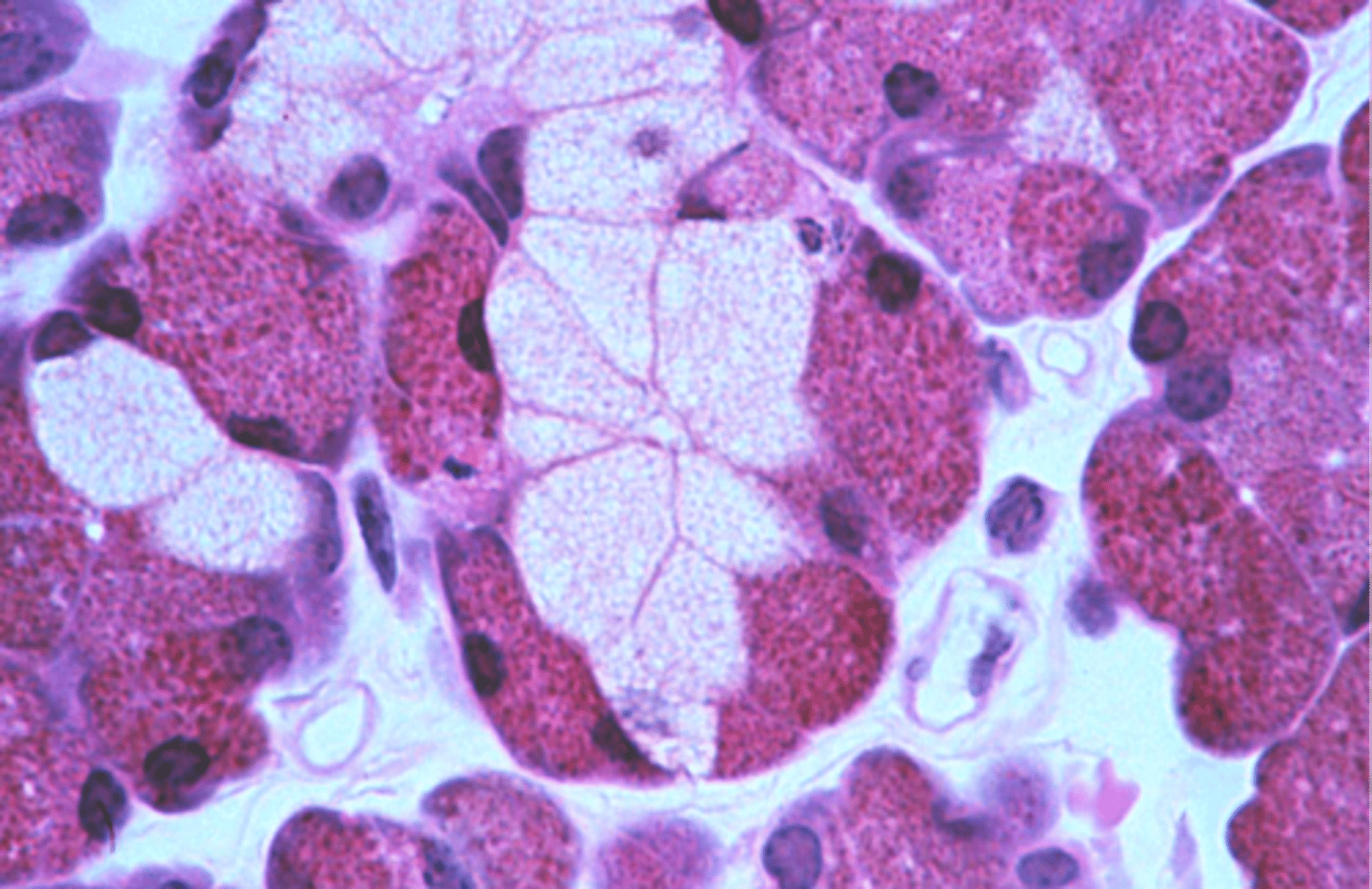 <p>A serous 'cap' over a mucous acini, found in the salivary glands.</p>