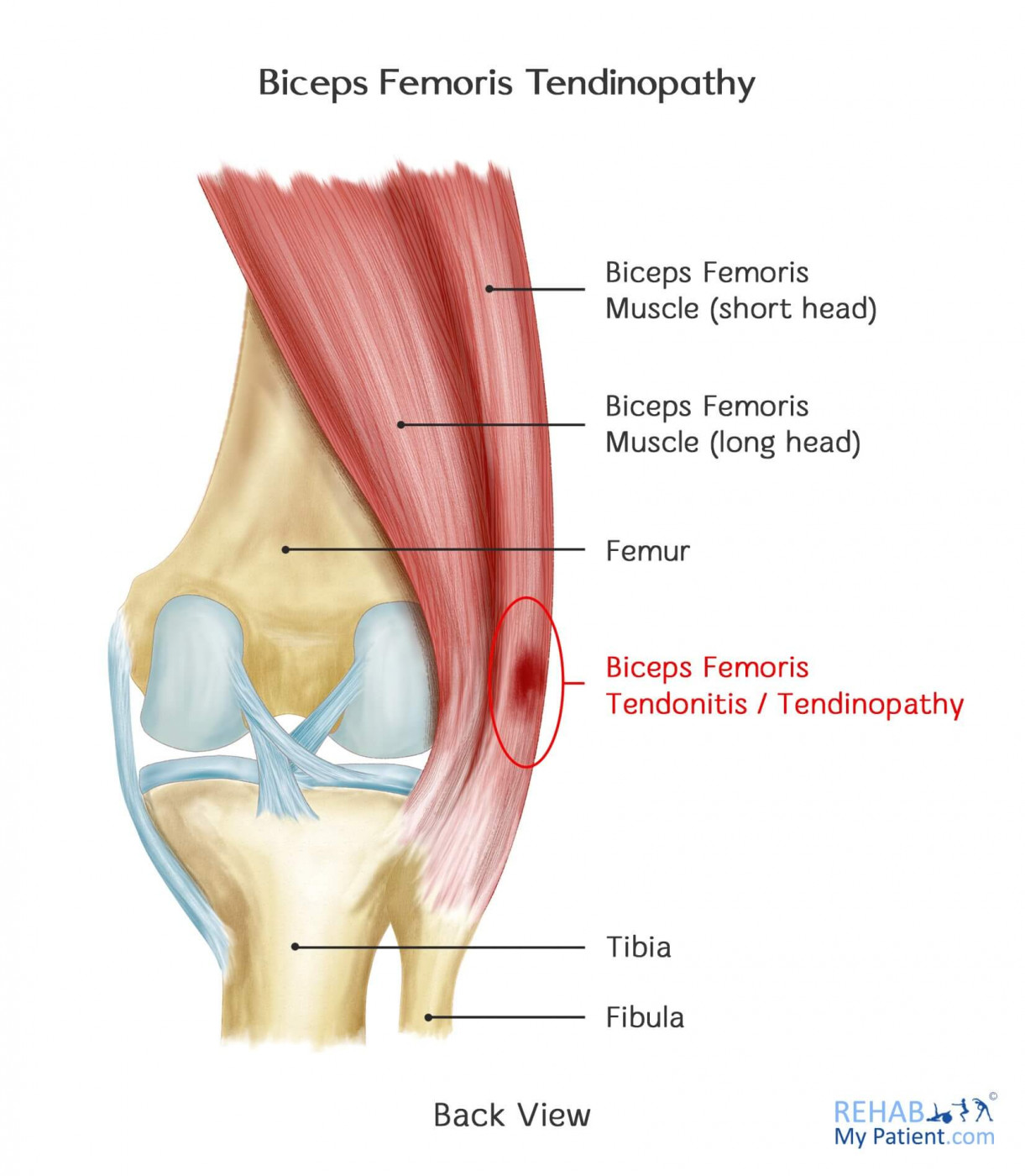 <p>Biceps Femoris</p>