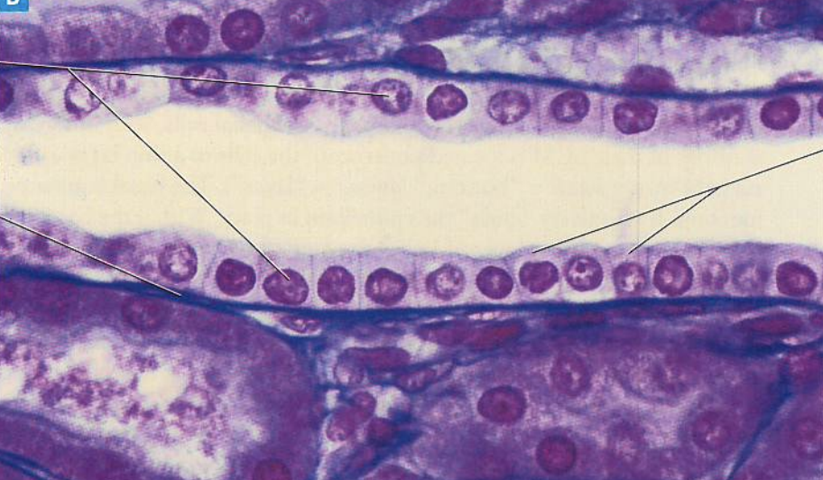 <p>What type of tissue is present in this image?</p>