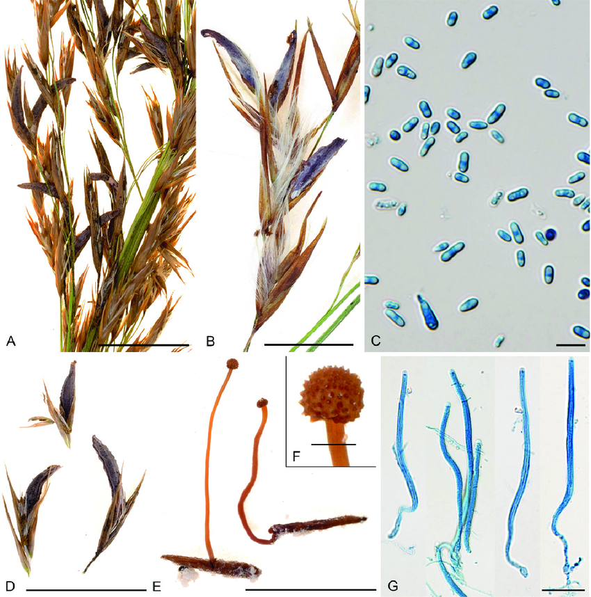 <p>Claviceps purpurea: Vad indikerar A, B och D på bilden?</p>