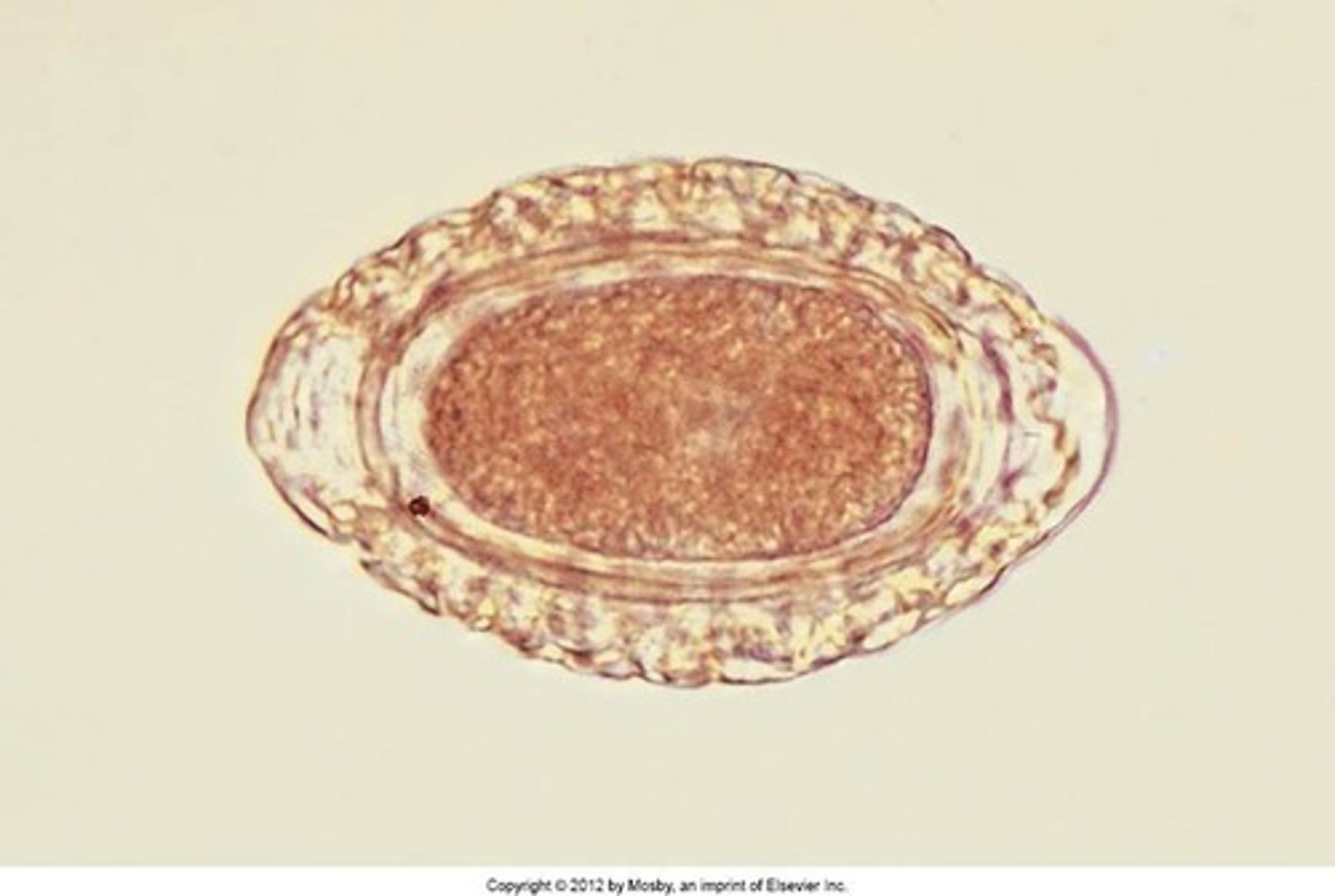 <p>canine giant kidney worm</p>