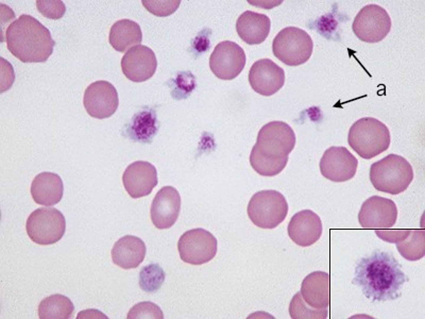 <p>A very small blood cell derived from the fragmented cytoplasm of megakaryocytes in the bone marrow. --------- participate in coagulation, wound healing, and inflammation</p>