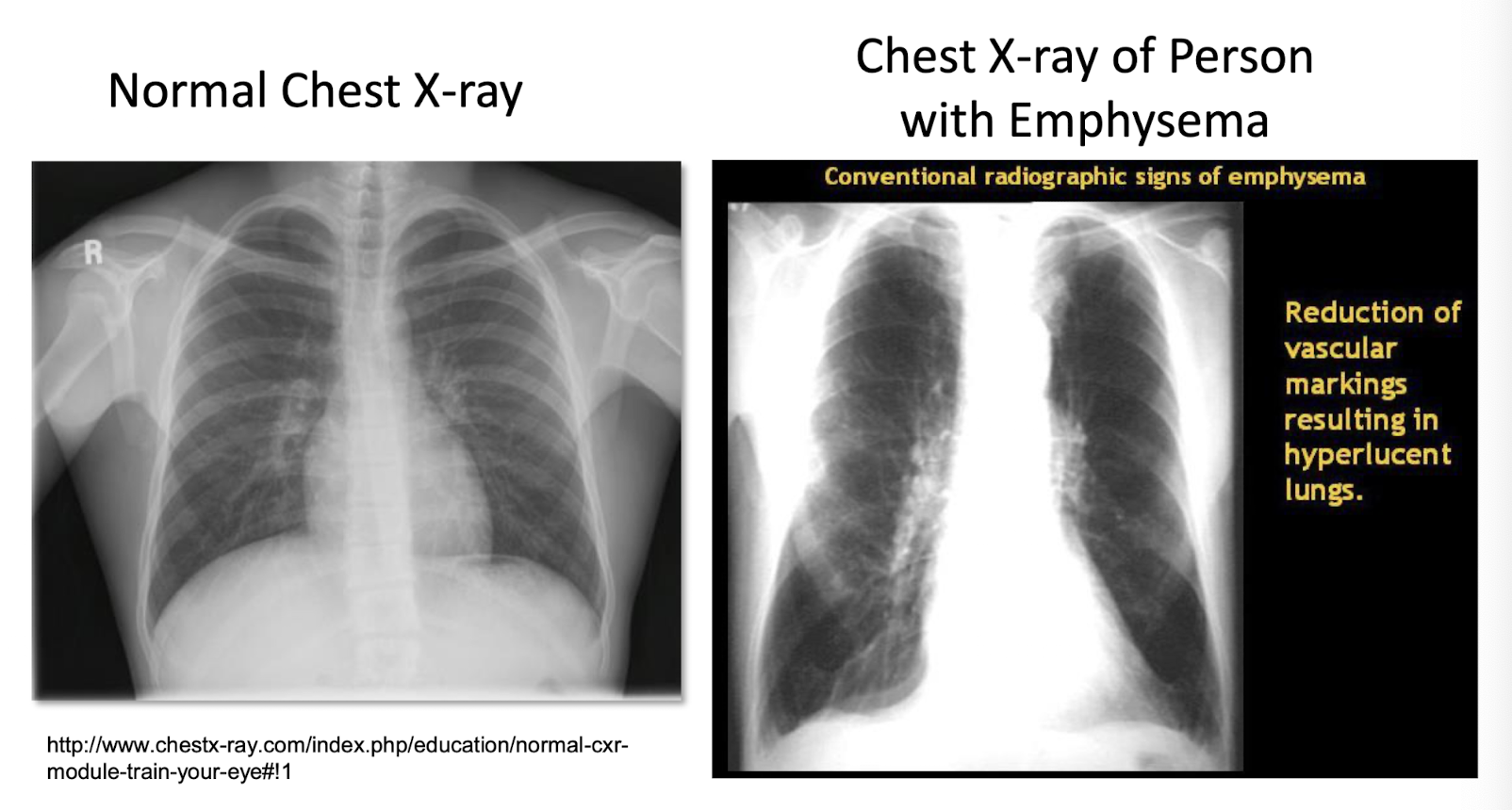 <p>What would breathing be like?</p>