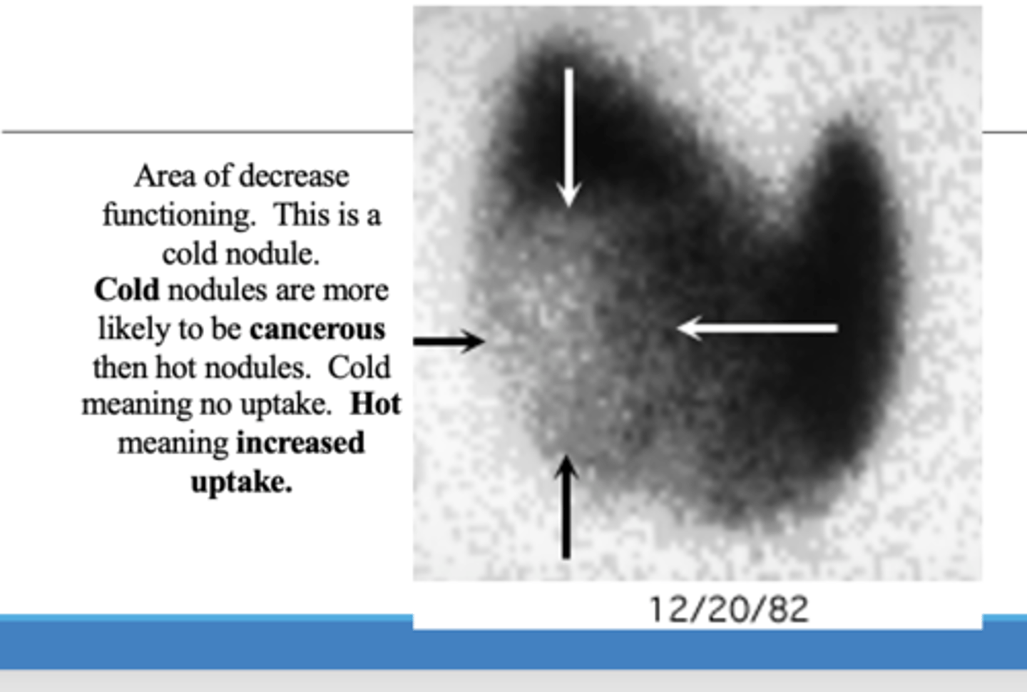 <p>⚬No CT scan or contrast media within the last 8 weeks.</p>