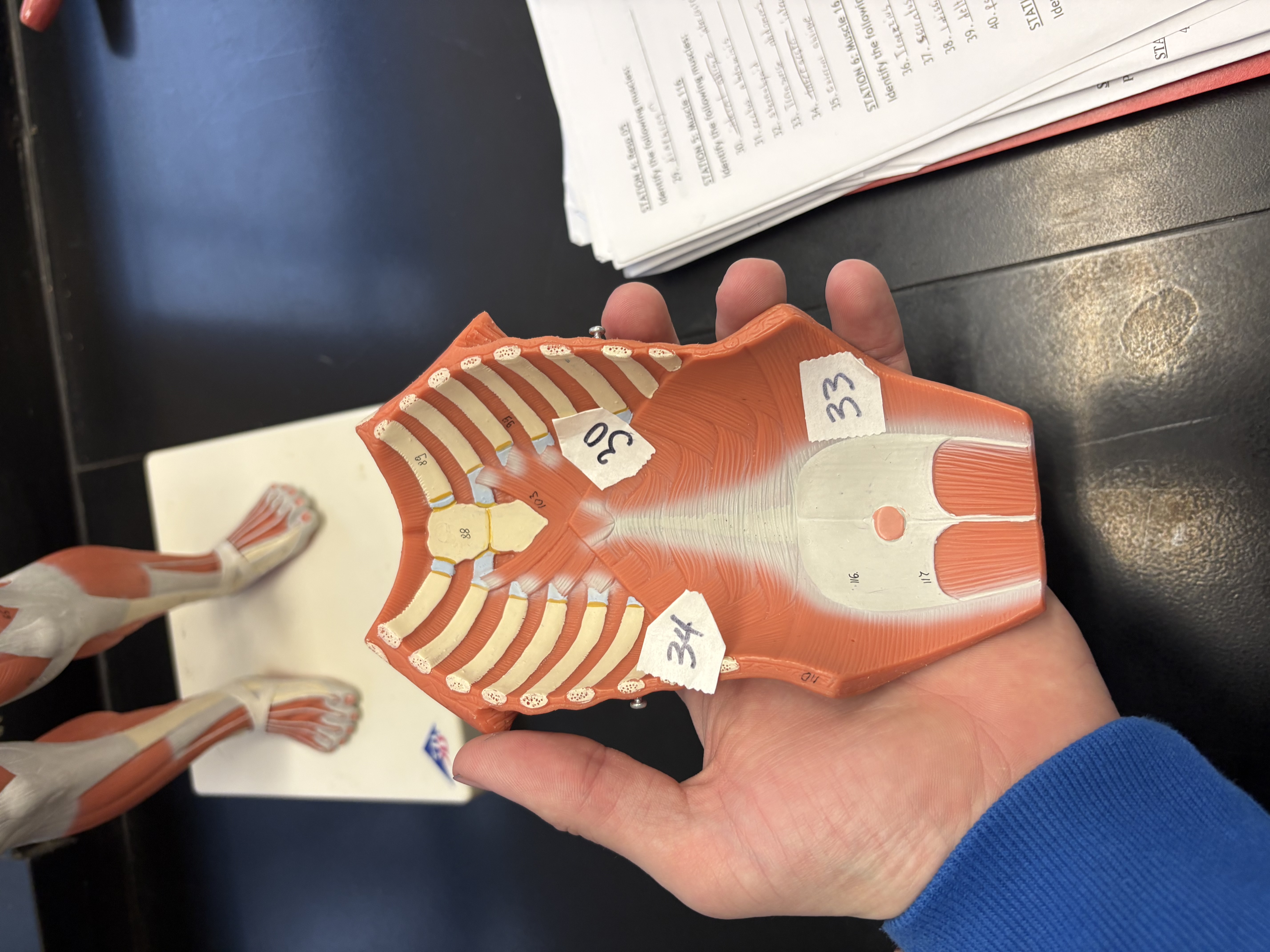 <p>flexes spine, rotates trunk, lateral flexion of turnk, compress wall (30)</p>