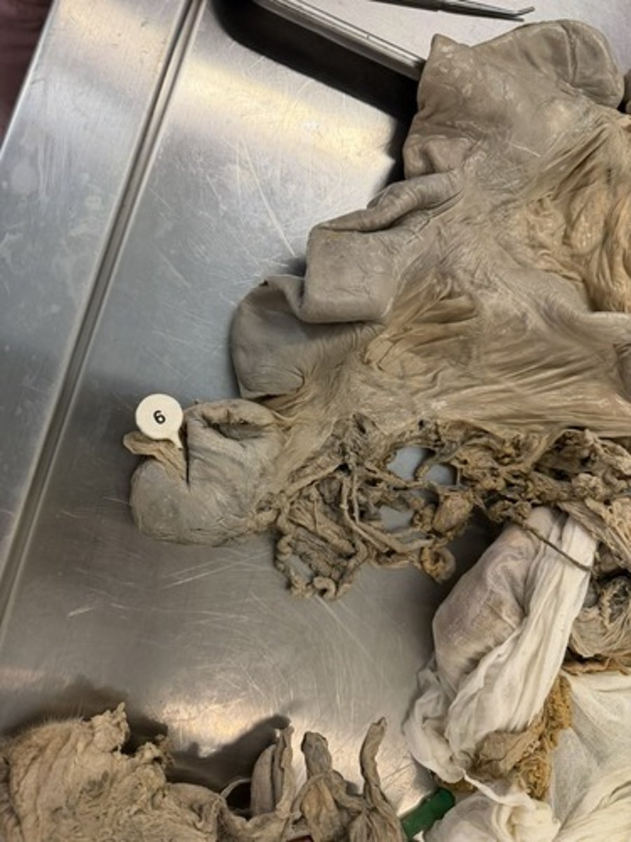 <p>A. ID this specific structure.</p><p>B. ID the domestic animal this specimen is from.</p>
