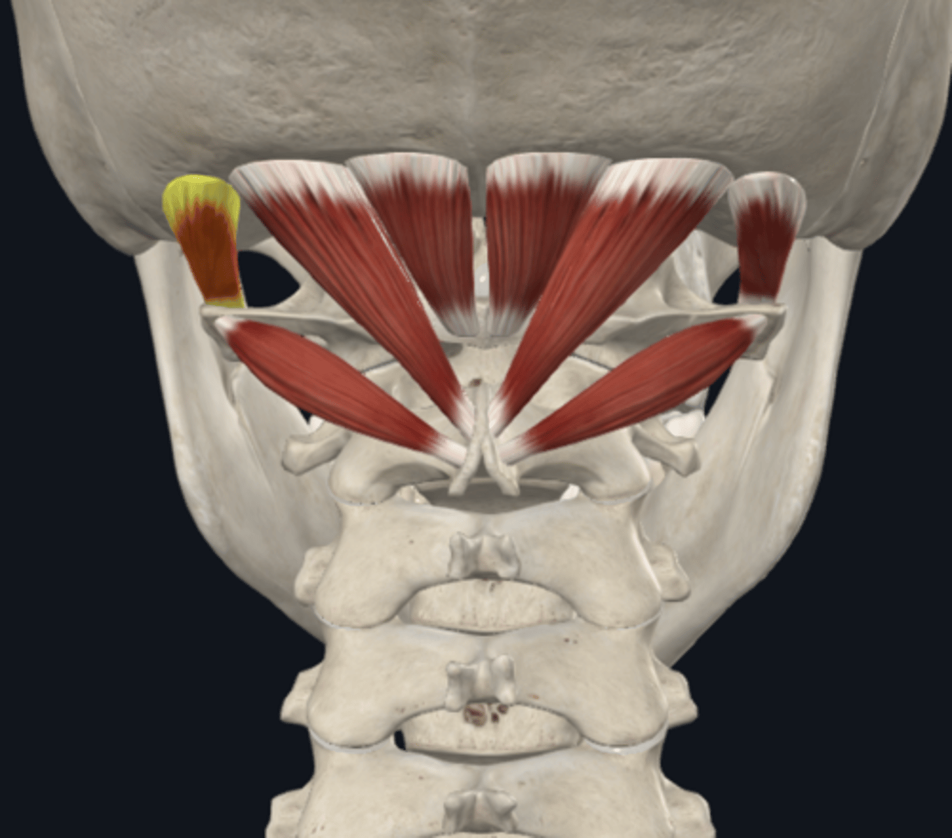 <p>What is the attachment of the Obliquus capitis Superior muscle of the suboccipital muscles?</p>