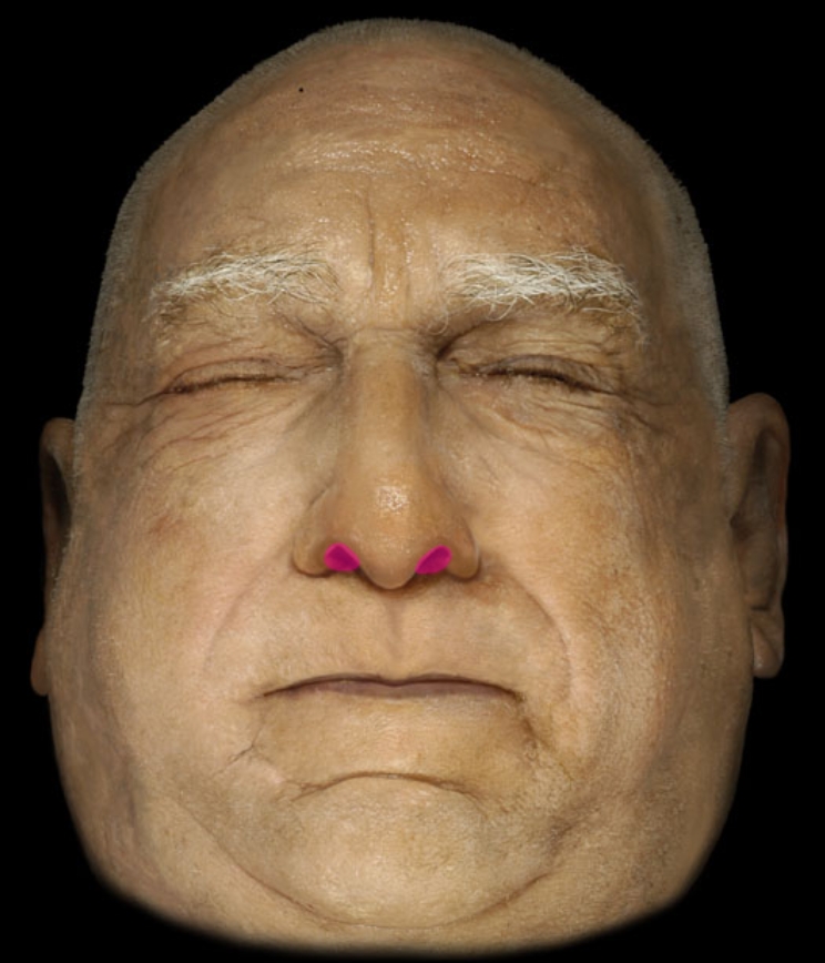 term image