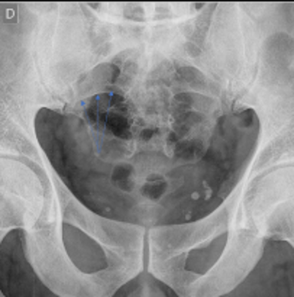 <p>What are the arrows pointing to?</p>