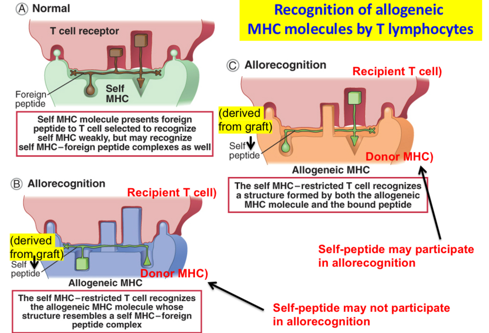 <p>Recognition of allogeneic MHC molecules may be thought of as a cross-reaction in which a T cell specific for a self MHC molecule–foreign peptide complex&nbsp;also recognizes an allogeneic MHC molecule whose structure resembles that of a self MHC molecule–foreign peptide complex. Peptides derived from the graft (labeled self peptide) may not contribute to allorecognition<strong>,</strong>&nbsp;or they may form part of the complex that the T cell recognizes<strong>.</strong>&nbsp;The type of T cell recognition depicted in&nbsp;<strong>B</strong>&nbsp;and<strong>C</strong>&nbsp;is direct allorecognition.&nbsp;</p>