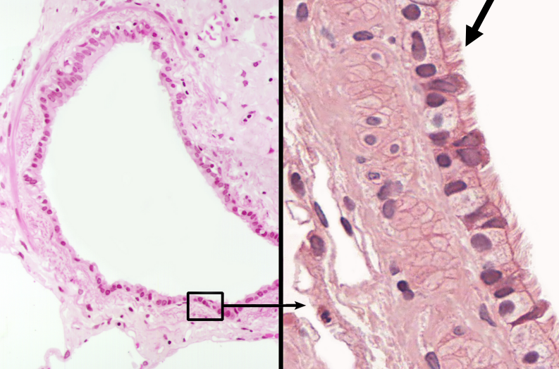 <p>Functions to move the cell using hair-like structures (cilia)</p><p>Location: Lines bronchioles of the respiratory tract, uterine tubes, and uterus</p>