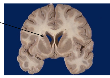 <p>Basal nuclei.</p>