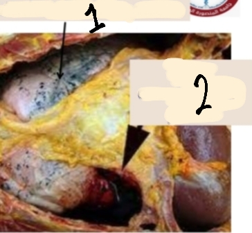 <p>identify ?</p><p>mention other types ?</p><p>Number 1,2 refer to what?</p>