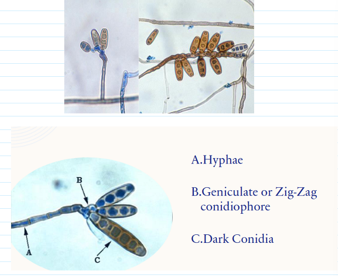 <ul><li><p><span>Gray/brown turning to black</span></p></li><li><p><span>Reverse is black</span></p></li><li><p><span>Matures in 5 days</span></p></li><li><p><span>genticulate/zig-zag conidiophore + dark conidia</span></p></li></ul><p></p>