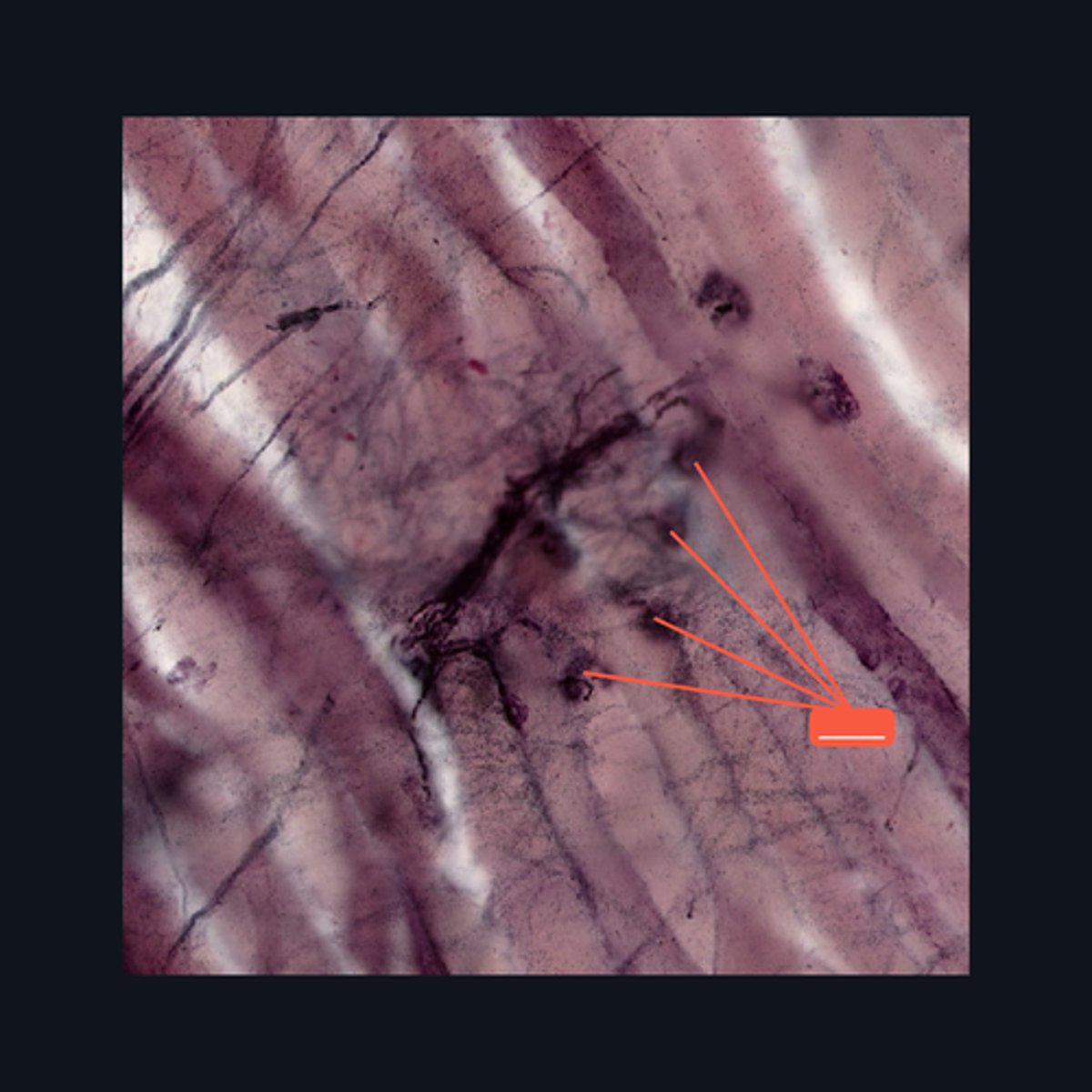 <p>Identify the structure</p>