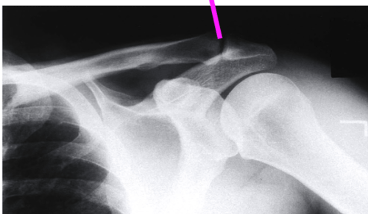 <p>what does the pink line point to?</p>