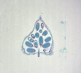 <p>Which fruit is being shown?</p>
