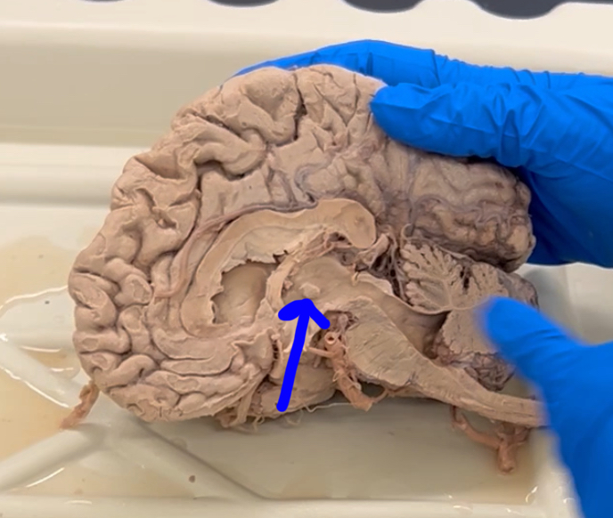 <p>What is this?</p>