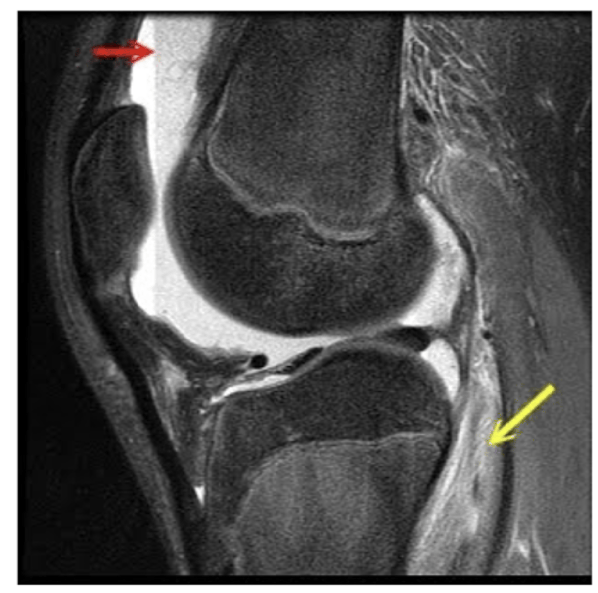 <p>Define the pathology.</p>