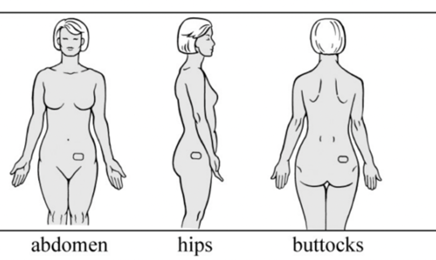 <p>abdomen, hip, butt</p><p>(no chest, back, or arm)</p>