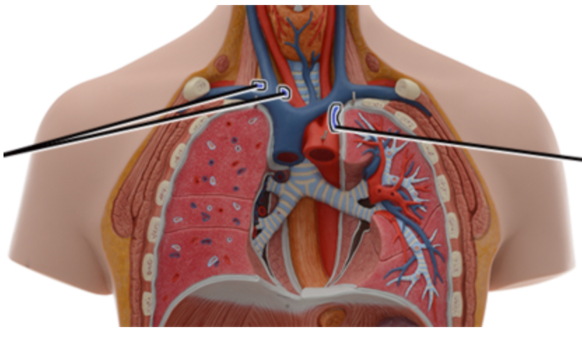 <p><span style="color: rgb(0, 0, 0);">Name this branch of the aorta.</span></p>