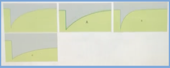 <p><span style="background-color: transparent;"><span>Shown here are FRAP results for the same membrane proteins after three treatments. The first curve represents untreated protein. The rest of the curves are taken after treating the membrane proteins to increase their membrane mobility. Which frame shows an increase in membrane motility? </span></span><br><span style="background-color: transparent;"><span>A. Both B and C</span></span></p><p><span style="background-color: transparent;"><span>B. C</span></span></p><p><span style="background-color: transparent;"><span>C. Both A and B</span></span></p><p><span><span>D. B</span></span></p><p><span style="background-color: transparent;"><span>E. A</span></span></p>
