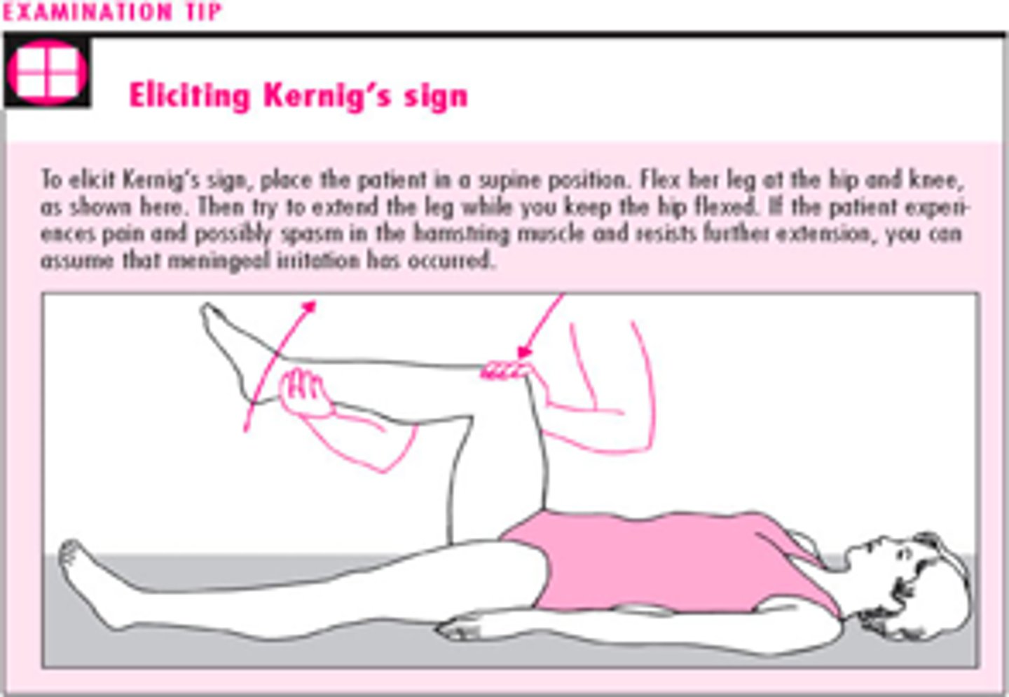 <p>inability to fully extend the knees with hips flexed 90 degrees</p>