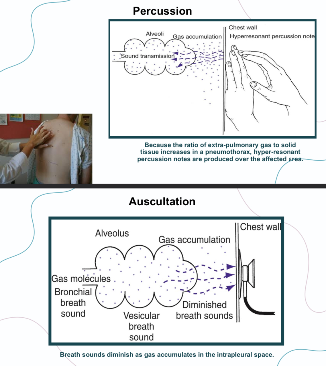 <p>Cyanosis: bluish discoloration of lips and nail beds due to decrease in O2 in blood</p><p>Inspection and palpation: chest not rising properly during inspiration</p><p>Percussion: hyper resonant note</p><p>Ascultation: diminished breathing sounds</p>