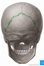 <p>joint; looks like top of triangle; between occipital and parietal</p>