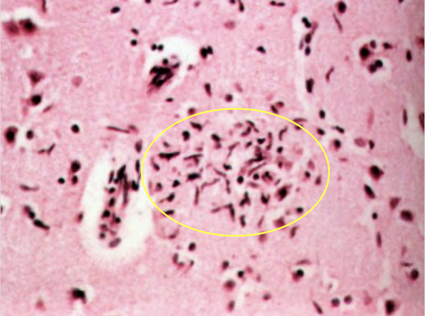 term image