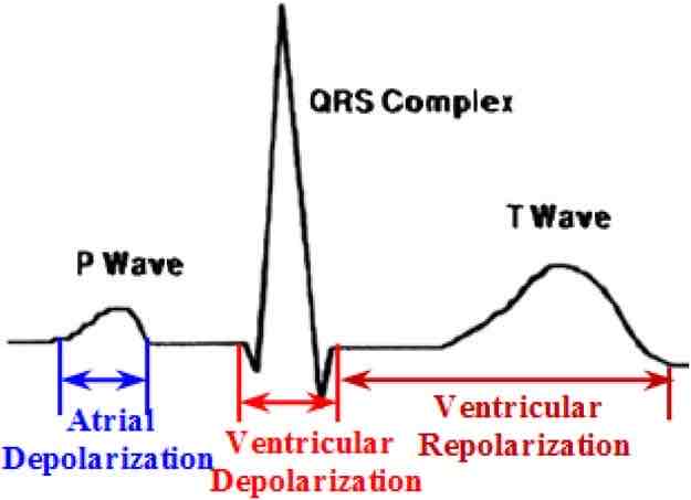 <p>What does the QRS complex represent on an electrocardiogram?</p>