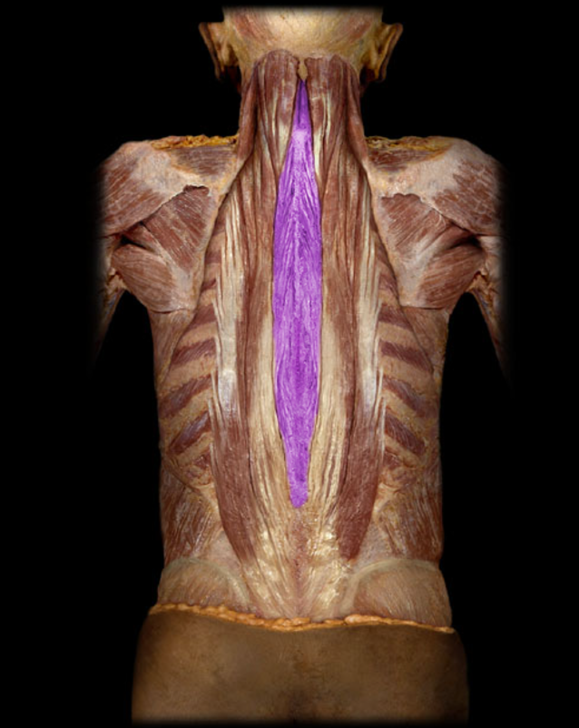 <p>Spinalis thoracis</p>