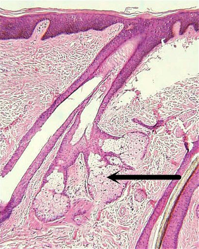 <p><span>- found everywhere on body except palms and soles of feet</span><br><span>- abundant on face, neck, upper chest, and upper back</span><br><span>- secrete an oily substance called sebum</span><br><span>- associated with hair follicle, softens/lubricates hair and skin</span><br><span>- non-coiled to hair follicle</span></p>