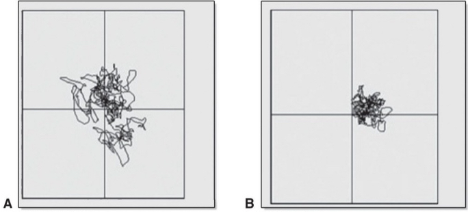 <p>keep in mind effects of medication state when seeing pt</p>